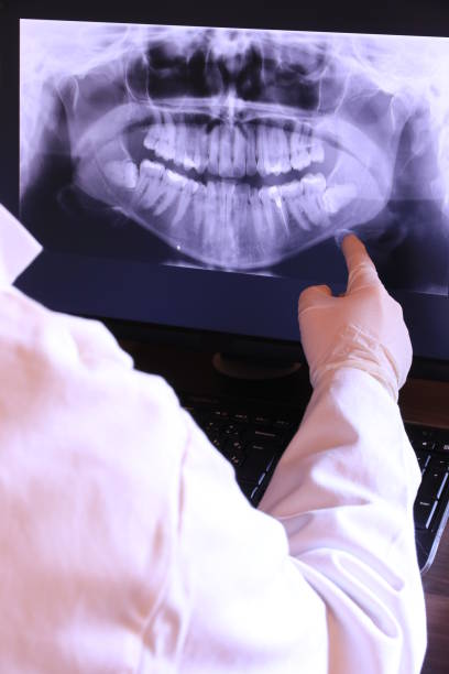 Best Emergency Dental Care for Broken or Chipped Teeth in Sergeant Bluff, IA